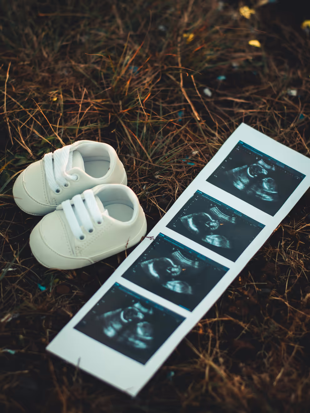 A pair of baby shoes beside a strip of ultrasound scan photographs.